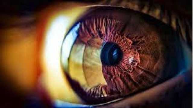 تعرف على العلامات الأولى لسرطان العين الأكثر شيوعا