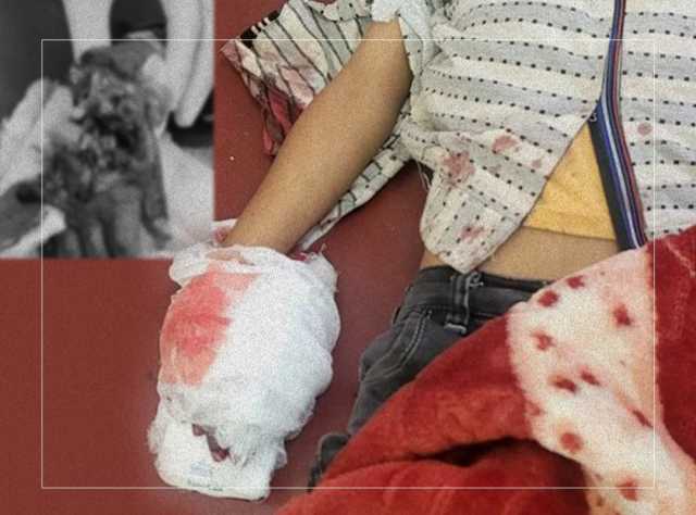 إصابة طفل بجروح خطيرة برصاص قناص حوثي في تعز