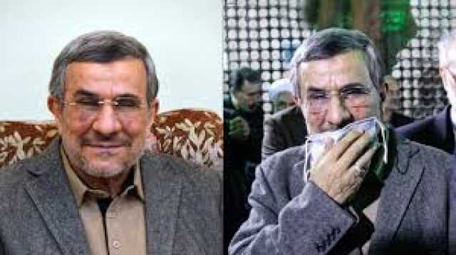 ظهور علامة وكدمات في وجه أحمدي نجاد تثير تساؤلات