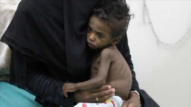 خبر غير سار من برنامج الاغذية العالمي لـ ملايين الأطفال في اليمن