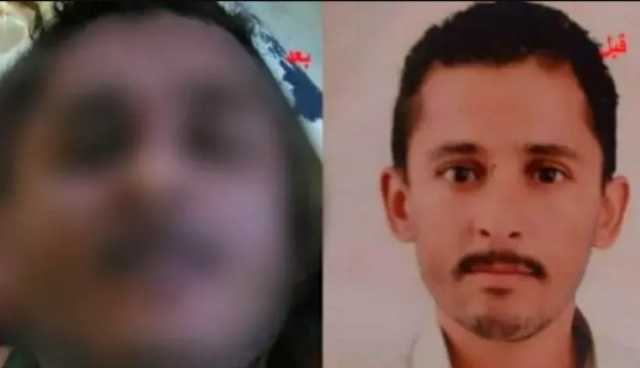 في ثالث حالة من نوعها خلال ثلاثة أشهر. وفاة مختطف في سجون مليشيا الحوثي بعد 7 سنوات من اختطافه