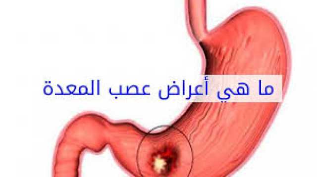 معلومات الأول مرة عن أسباب المعدة العصبية وأعراضها وطرق علاجها