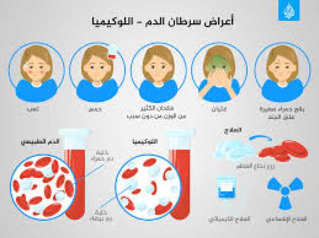 اعراض سرطان الدم بالتفصيل ومتى تظهر تلك الأعراض