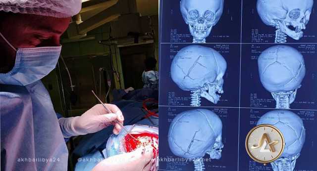 طبي بنغازي ينجح في إنقاذ رضيع أصيب بكسر خطير في الجمجمة