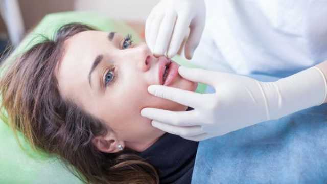 عملية رفع الشفة العلوية LIP LIFTING وتأثيرها على الأعصاب