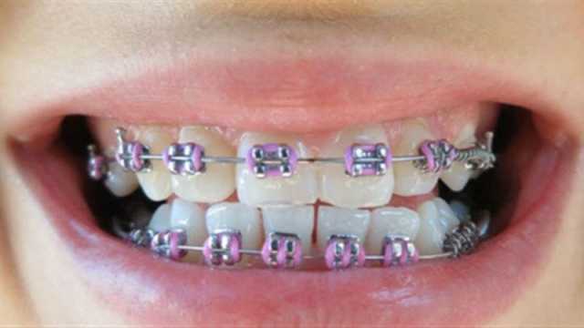 أفضل دكتور تقويم أسنان في جدة: 9 دكاترة ننصحك بهم