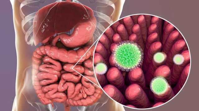 فيروس الروتا: الأعراض، الأسباب، العلاج
