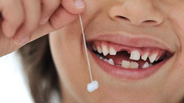 تفسير حلم سقوط الأسنان للعزباء لكبار المفسرين