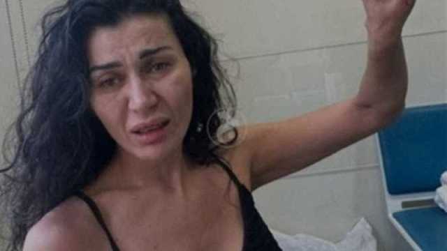 بعد تعرضها للضرب المبرح على يد شقيقها نادين الراسي:(الله العدل!)