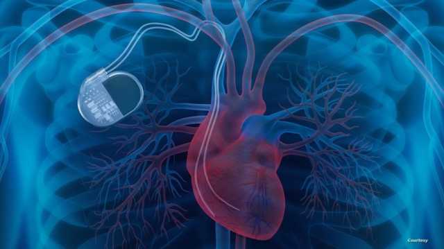 ضربات القلب السريعة بسبب القلق.. ما خطورتها؟ وكيف يمكن إبطاؤها؟