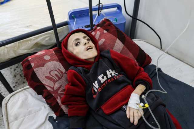 يزن الكفارنة أحدهم.. الموت جوعا يحصد أرواح 16 طفلا في غزة ويتربص بآخرين