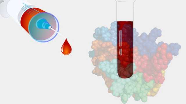 علماء يكشفون ألزهايمر عبر اختبار دم بسيط