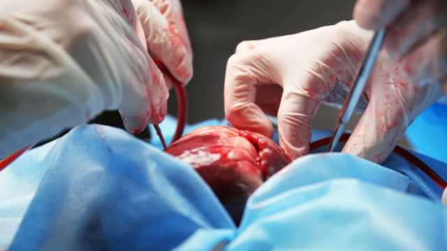 زرع قلب خنزير في جسم إنسان للمرة الثانية بأقل من عامين