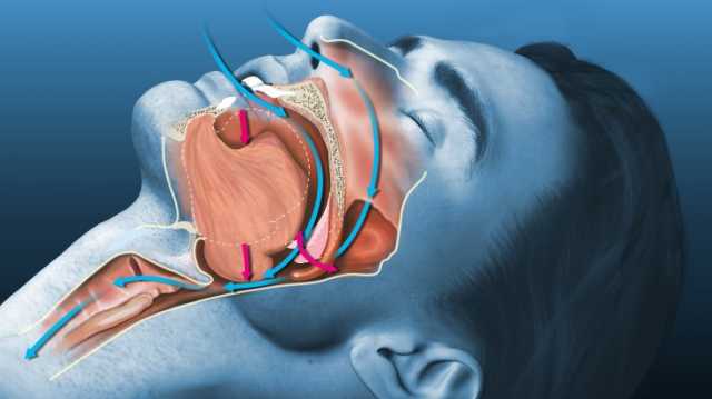 وضعية النوم تسبب الشخير.. فما أعراضه وعلاجه؟