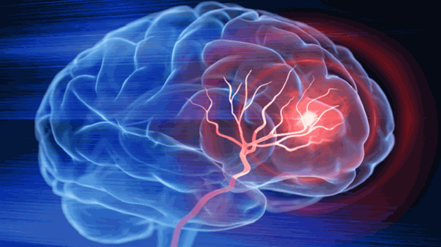 انجاز علمي جديد.. تطوير جهاز يستكشف سرطان الدماغ الأكثر خطورة