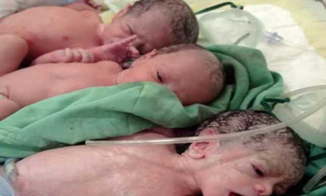 ولادة ثلاثة توائم بأحد مستشفيات صنعاء