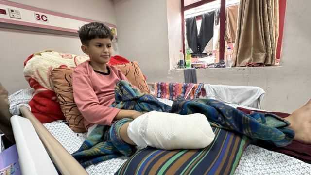 أكثر من 10 أطفال يفقدون أطرافهم في غزة يوميا وسط تفاقم الأزمة الصحية