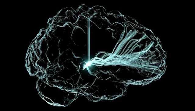 تطوير غرسات دماغية تعالج الاكتئاب والألم المزمن