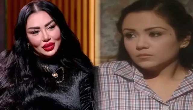 فنانة مصرية تثير الجدل بتغيير ملامحها.. وتردّ على التنمّر