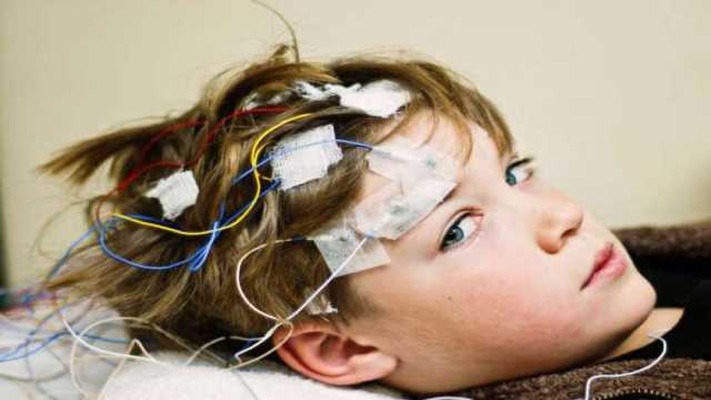 هل يمكن الشفاء من كهرباء المخ؟ وكيف يمكن التعايش معها