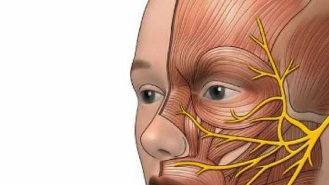 11 عرضا تدل على الإصابة بـ«شلل الوجه».. استشر الطبيب فورا في هذه الحالة