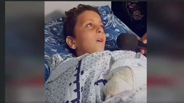 وصول الطفل الفلسطيني المصاب عبد الله كحيل للعلاج في مصر