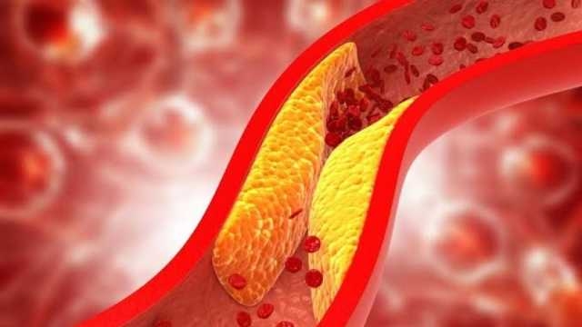 يساعد على انخفاض الكوليسترول في الدم.. دراسة حديثة تكشف عن فوائده