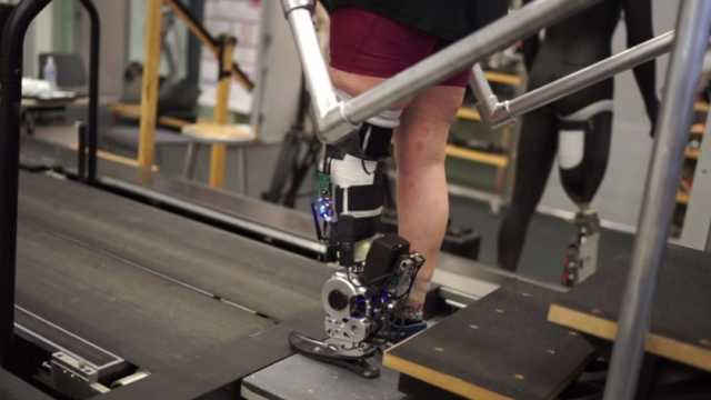 تتحكم فيها كأنها حقيقية.. اختراع ساق اصطناعية تعمل بطاقة الدماغ