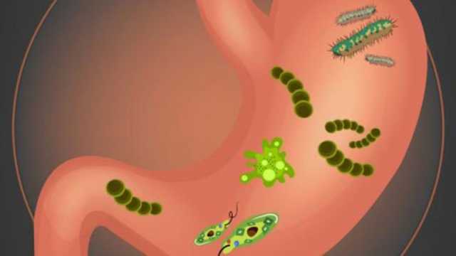 4 طرق لتجنب الإصابة بها.. هل جرثومة المعدة مرض معدي؟