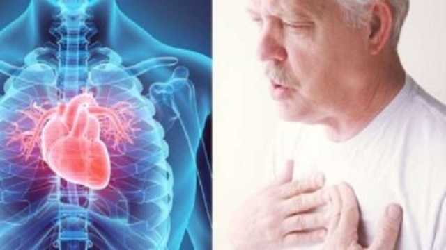 أمراض صمام القلب تزيد من خطر الإصابة بالسكتات الدماغية.. احذر الأعراض