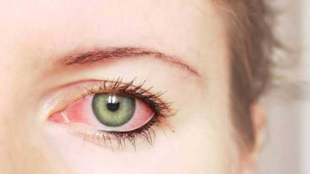 أسباب الإصابة بالعين السكري وطرق الوقاية منها