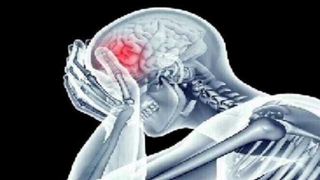 علامات مبكرة للجلطة الدماغية وطرق وقاية منها