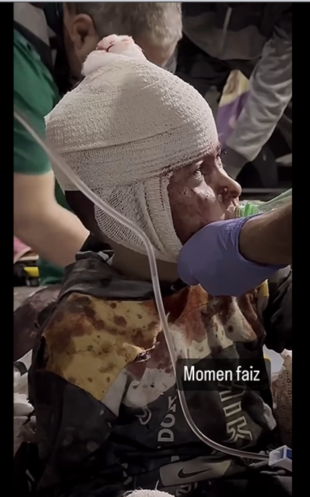 بالفيديو .. هذا بنك أهداف الاحتلال .. طفل أصيب في قصف الاحتلال المستمر على مدينة غزة