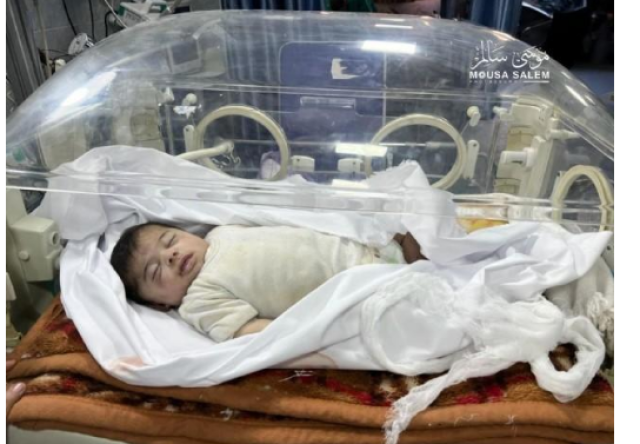 استشهاد الرضيعة الزبدة بسبب الجوع في مستشفى بشمال غزة