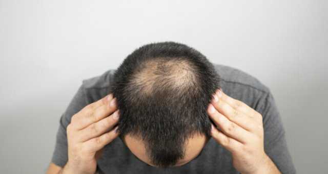 دواء شائع لعلاج تساقط الشعر وتضخم البروستات يظهر فائدة أخرى منقذة للحياة