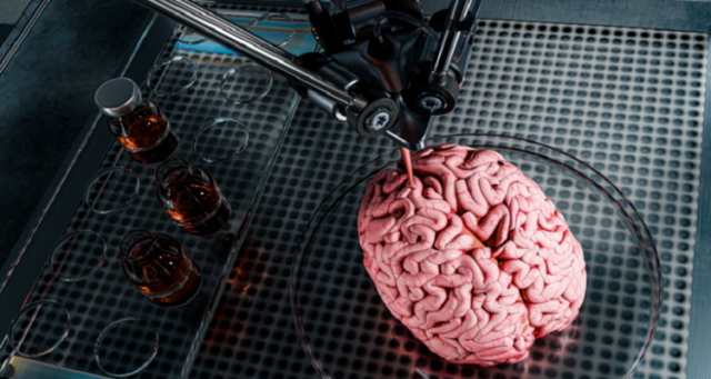 نظاما ميكانيكيا يعتمد على الذكاء الاصطناعي لإجراء عمليات زرع الرأس