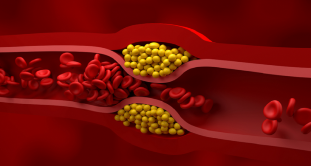 اكتشاف يقلب المفاهيم التقليدية حول الكوليسترول الجيد