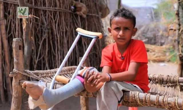 خلال أغسطس الماضي.. 'أونمها' تعلن سقوط 20 ضحية في الحديدة جراء الألغام الحوثية