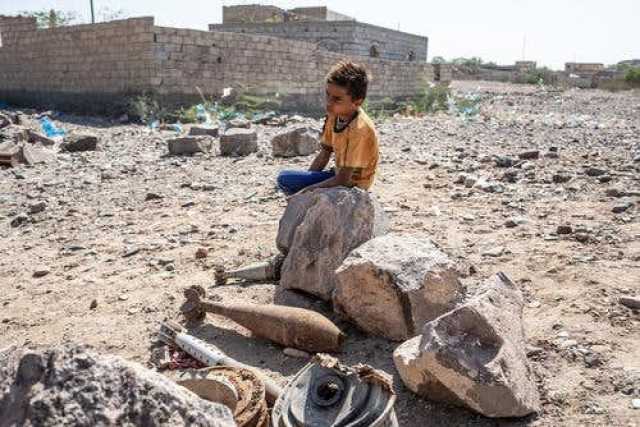 إصابة طفل جراء إنفجار جسم من مخلفات الحرب بمحافظة الحديدة