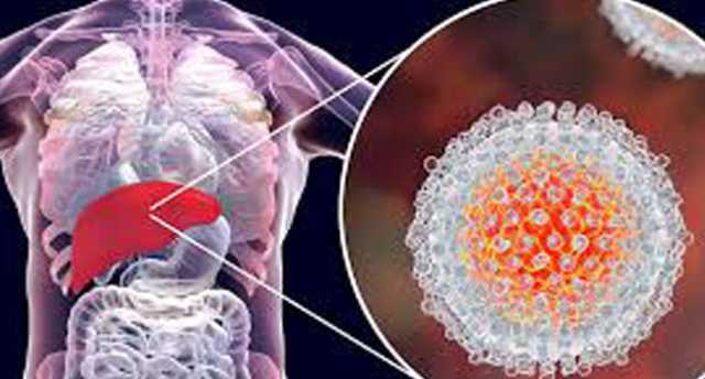 254 مليون مصاب .. الصحة العالمية.. «الكبد الفيروسي» يودي بحياة 3500 شخص يومياً
