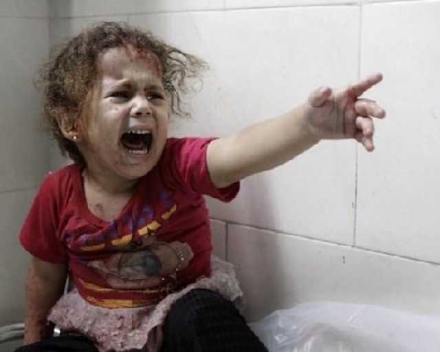 منظمة إنقاذ الطفولة:أكثر من 10 أطفال يفقدون أحد سيقانهم أو كليهما يومياً في غزة