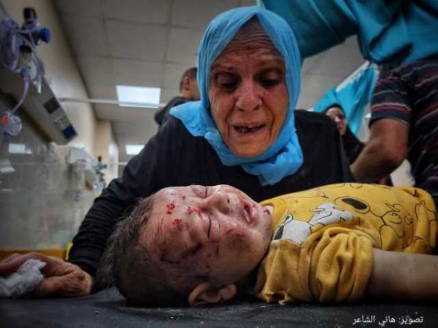 وفاة 15 طفلا في غزة نتيجة سوء التغذية والجفاف في مستشفى كمال عدوان