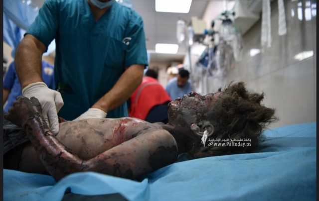العدو الصهيوني يواصل عدوانه بحق أطفال ونساء غزة في اليوم ال17 على التوالي