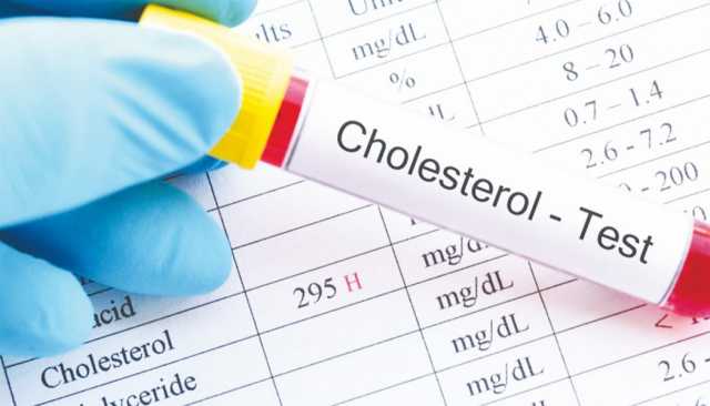 تقلب مستوى الكوليسترول يرتبط بمخاطر الخرف