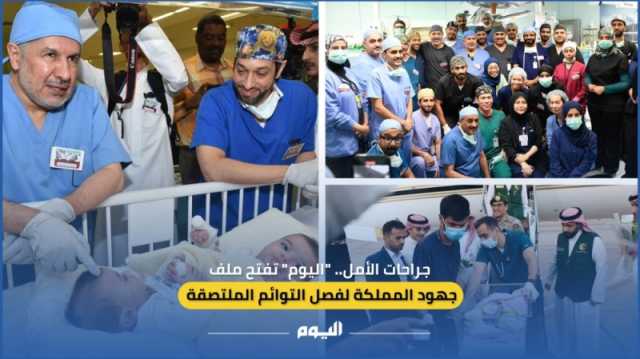 جراحات الأمل.. 'اليوم' تفتح ملف جهود المملكة لفصل التوائم الملتصقة