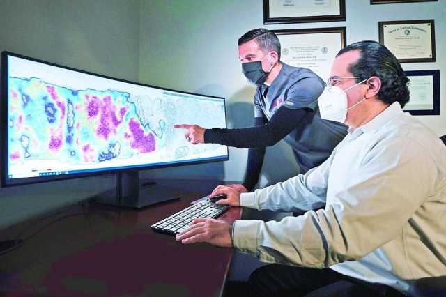 دراسة تتوقع زيادة كبيرة في معدلات الإصابة بسرطان البروستاتا