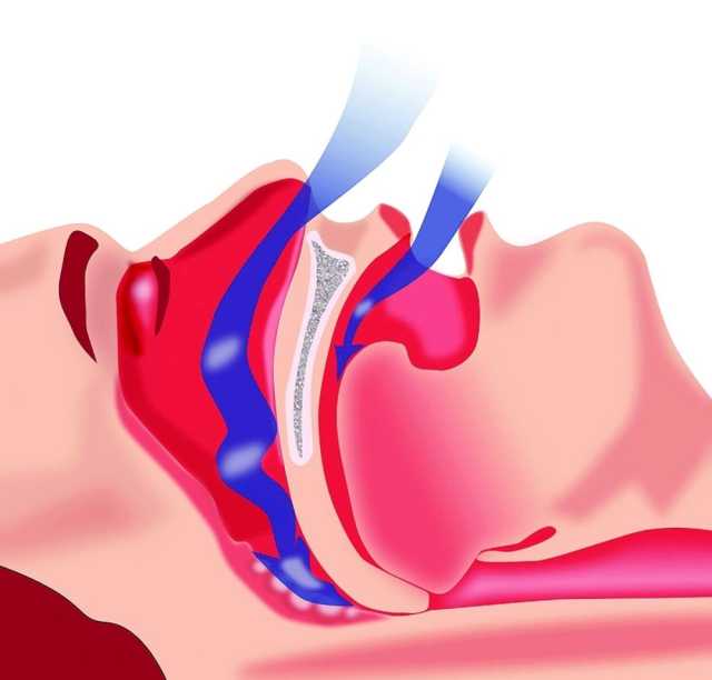 انقطاع النفس.. أكثر أمراض اضطرابات النوم شيوعاً في عمان