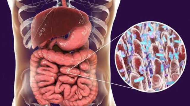 عادات يومية تدمر القولون دون أن تدرك.. تجنب 5 أخطاء شائعة