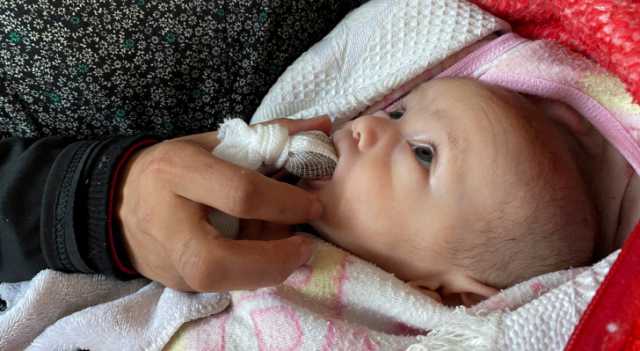 صحة غزة: ارتفاع حصيلة شهداء الأطفال إلى 27 نتيجة سوء التغذية شمال القطاع