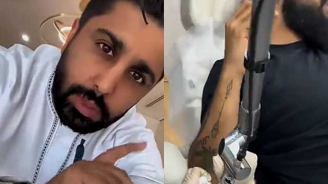 فهد العرادي يتبرع بحجز عيادة كاملة لإزالة الوشوم بالكويت .. فيديو